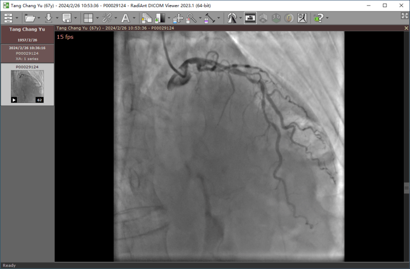 心脏造影视频播放器 | RadiAnt DICOM Viewer / Dicom Viewer（v2025.1 / v3.0.28.1210）-咕噜噜柠檬网